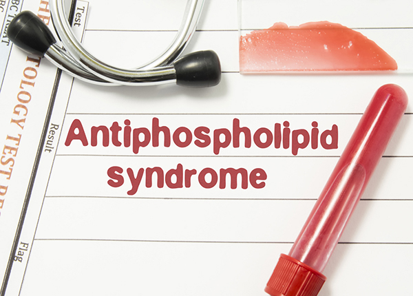 Nguyên nhân và triệu chứng của hội chứng kháng thể kháng Phospholipid