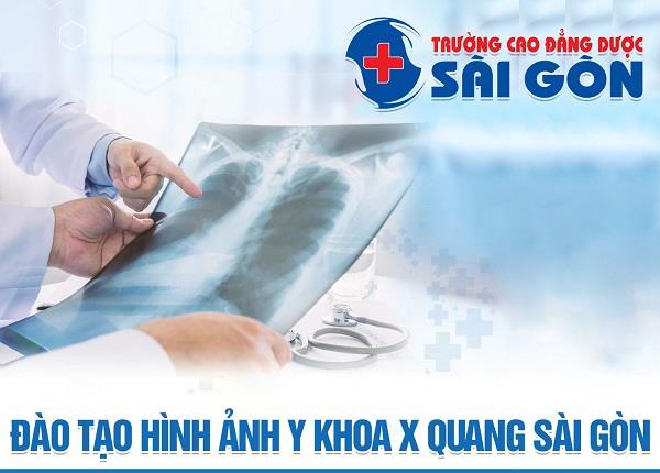 Thành phố Hồ Chí Minh tuyển sinh đào tạo Kỹ thuật chẩn đoán hình ảnh Y học Sài Gòn