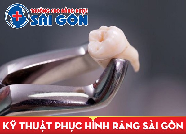 Thông báo tuyển sinh VB2 Trung cấp Kỹ thuật phục hình răng Sài Gòn năm 2019
