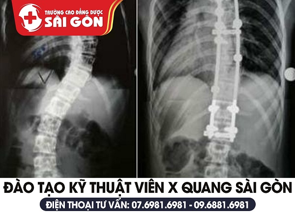 Đào tạo kỹ thuật viên X Quang tại Sài Gòn