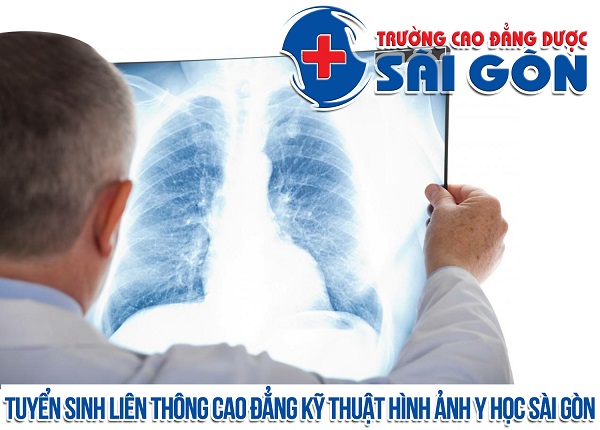 Trường Cao đẳng Dược Sài Gòn tuyển sinh Liên thông Cao đẳng Kỹ thuật hình ảnh Y học  Sài Gòn