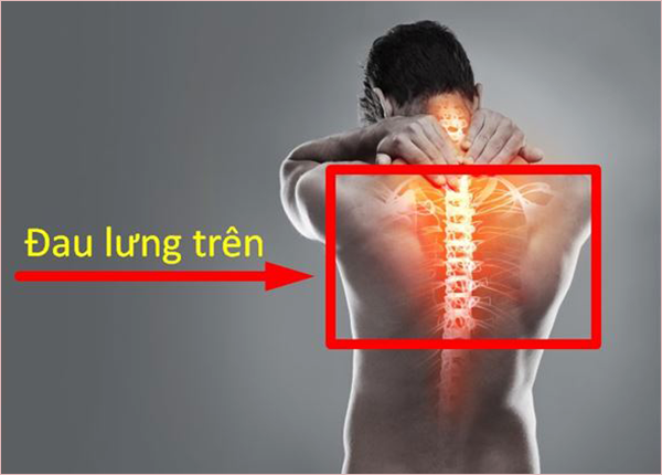 Bác sĩ Trường Dược Sài Gòn giải thích về hiện tượng đau lưng trên