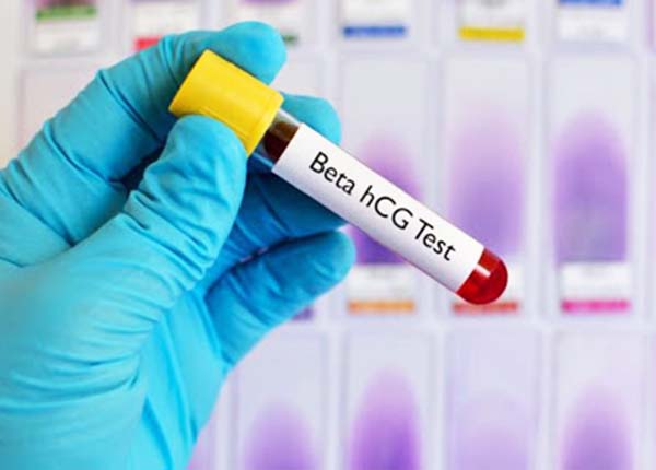 Bác sĩ Trường Dược Sài Gòn hướng dẫn về ý nghĩa của xét nghiệm Beta HCG