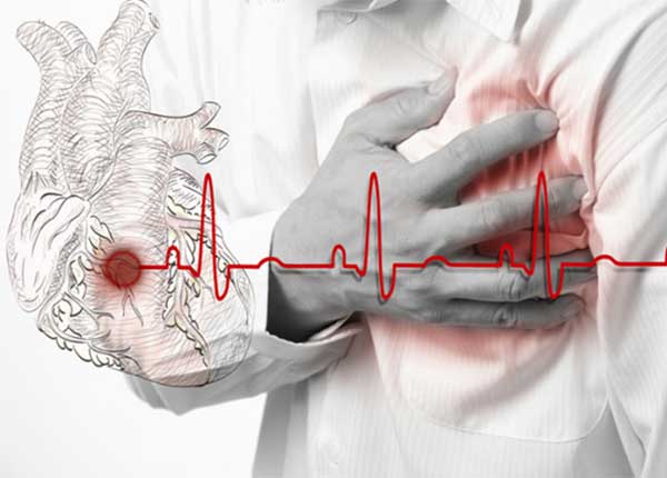 Mọi người hay nhầm lẫn giữa cơn đau tim và đột quỵ