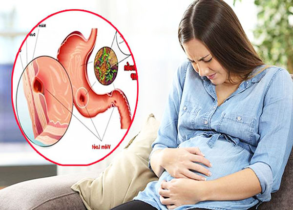Sử dụng thuốc đau dạ dày ở bà bầu có ảnh hưởng đến thai nhi không?