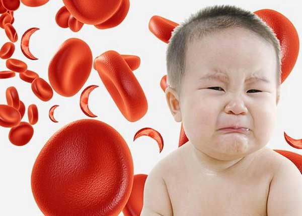 Thiêu máu ở trẻ em ảnh hưởng tới sự phát triển của trẻ nhỏ