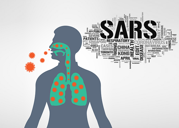 Tìm hiểu về hội chứng hô hấp cấp tính nặng Sars