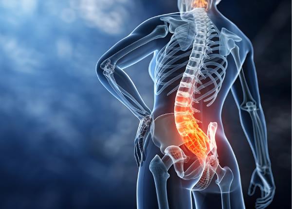Căng cơ thắt lưng: Dấu hiệu nhận biết và hướng điều trị hiệu quả
