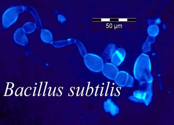 Chuyên gia Dược Sài Gòn hướng dẫn dùng men vi sinh Bacillus Subtilis, Bacillus Clausil