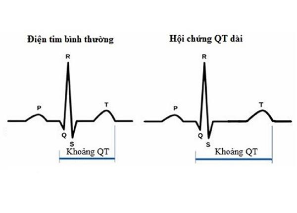 Cùng Bác sĩ Trường Dược Sài Gòn tìm hiểu về hội chứng QT kéo dài