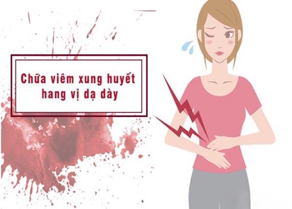 Dược sĩ Trường Dược Sài Gòn chia sẻ thuốc điều trị viêm xung huyết hang vị dạ dày