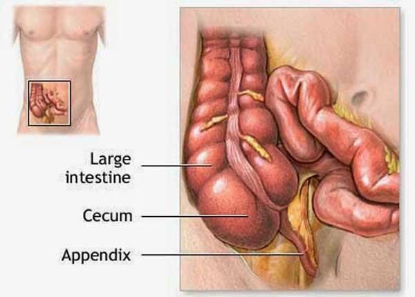 Tìm hiểu dấu hiệu ung thư ruột thừa cùng Điều dưỡng viên Sài Gòn