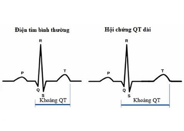 Tim hiểu về hội chứng QT kéo dài từ B.s Trường Dược Sài Gòn