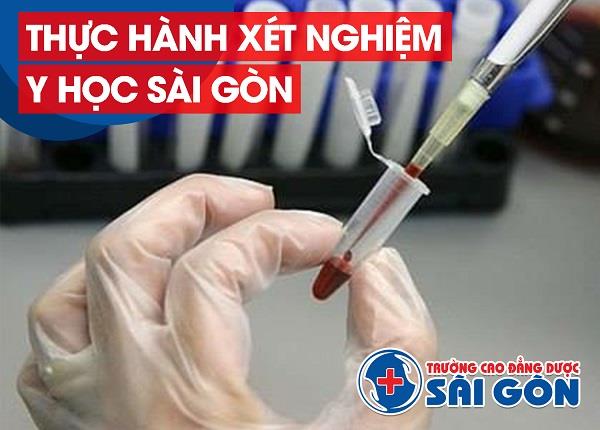 TPHCM tuyển sinh VB2 Cao đẳng Xét nghiệm Sài Gòn cần điều kiện gì?